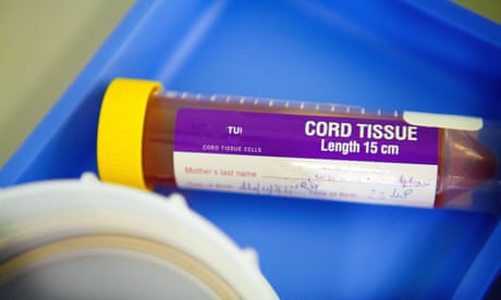 ‘Forever chemicals’ detected in all umbilical cord blood in 40 studies