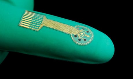 ‘Smart bandage’ with biosensors could help chronic wounds heal, study claims