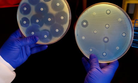 Antimicrobial resistance now a leading cause of death worldwide, study finds