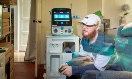 Dialysis machine inspired by juice dispenser wins UK engineering prize
