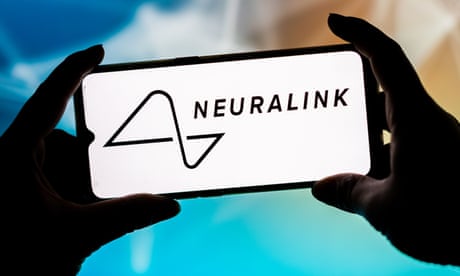 Elon Musk’s brain chip company, Neuralink, faces animal abuse claims