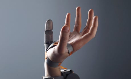 Human augmentation with robotic body parts is at hand, say scientists