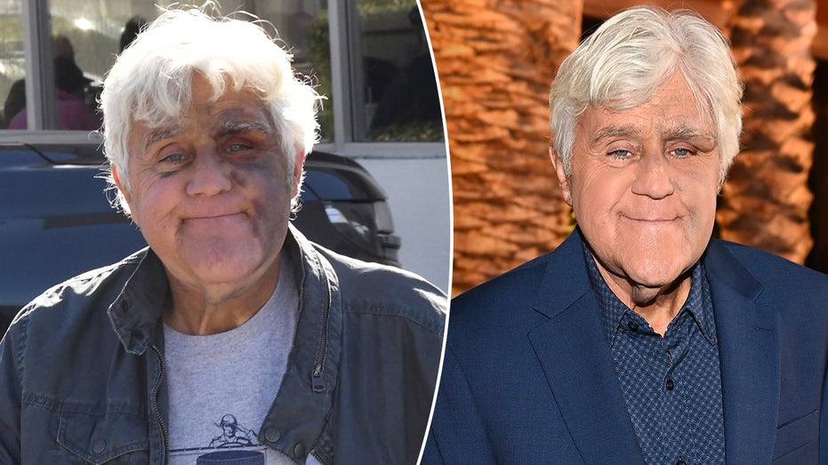 Jay Leno 'feeling good' despite suffering bruised face from fall