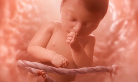 ‘Meet Baby Olivia’: spate of new bills would require showing anti-abortion video in schools