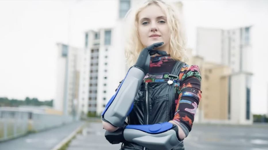 Wireless, waterproof bionic arm with 360-degree wrist rotation